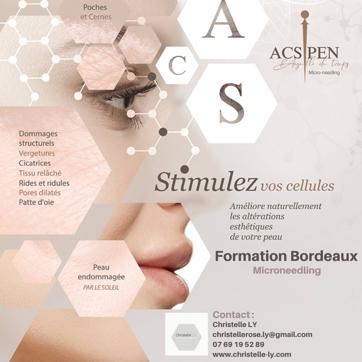 Formation microneedling Bordeaux